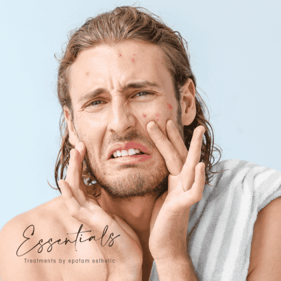 Protocole Éclat sans imperfections - peaux acnéiques
