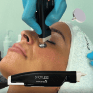 Pack Plasma Froid complet AVEC l'appareil - Dispositif esthétique pour soins visage et corps