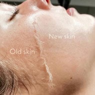 [Protocolo] Korean Glass Skin