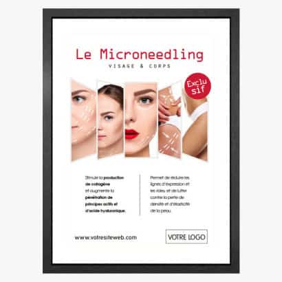 PLV Microneedling