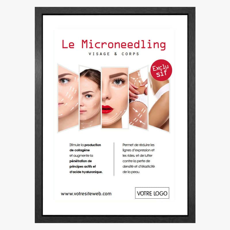 PLV Microneedling