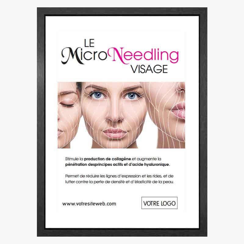 PLV Microneedling