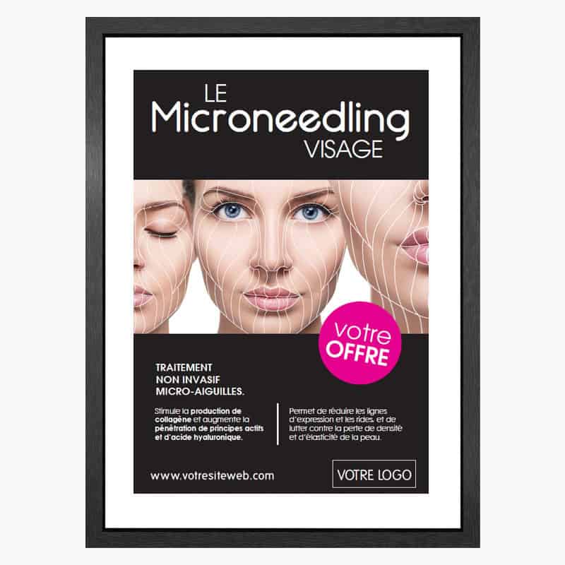 PLV Microneedling
