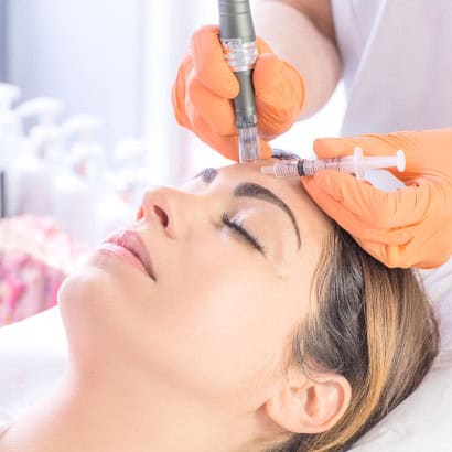 Formation Microneedling - EN LIGNE