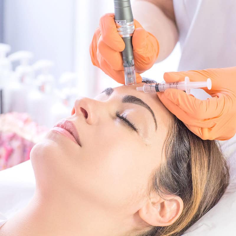 Formation Microneedling - EN LIGNE