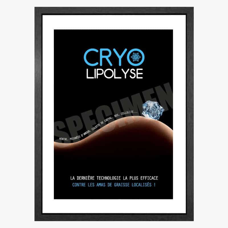 PLV Cryolipolyse
